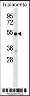 Neuregulin 3 antibody, 62-188, ProSci, Western Blot image 