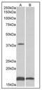 Beta-1,3-Glucuronyltransferase 1 antibody, AP32143PU-N, Origene, Western Blot image 