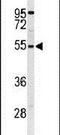 Ribosomal Protein S6 Kinase B2 antibody, PA5-26010, Invitrogen Antibodies, Western Blot image 