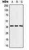 Aldolase, Fructose-Bisphosphate B antibody, orb216010, Biorbyt, Western Blot image 