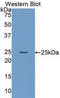 Laminin Subunit Alpha 4 antibody, LS-C298128, Lifespan Biosciences, Western Blot image 