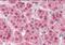 PARP2 antibody, NB100-2556, Novus Biologicals, Immunohistochemistry frozen image 