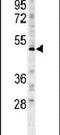 Forkhead Box C2 antibody, PA5-24588, Invitrogen Antibodies, Western Blot image 