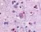 Glutamate Metabotropic Receptor 1 antibody, NLS879, Novus Biologicals, Immunohistochemistry paraffin image 