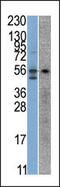 Serine/Threonine Kinase 38 antibody, 62-638, ProSci, Western Blot image 