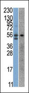 Serine/threonine-protein kinase 38 antibody, 62-638, ProSci, Western Blot image 