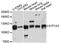 ATPase Na+/K+ Transporting Subunit Alpha 2 antibody, A13805, ABclonal Technology, Western Blot image 