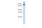 NDC1 Transmembrane Nucleoporin antibody, 26-120, ProSci, Western Blot image 