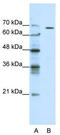 Gamma-Aminobutyric Acid Type A Receptor Theta Subunit antibody, TA338584, Origene, Western Blot image 