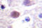 Protein Kinase, DNA-Activated, Catalytic Subunit antibody, LS-C176505, Lifespan Biosciences, Immunohistochemistry frozen image 