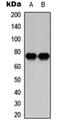 Protein Kinase C Beta antibody, orb304520, Biorbyt, Western Blot image 
