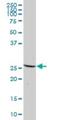 Dynactin Subunit 6 antibody, H00010671-B01P, Novus Biologicals, Western Blot image 