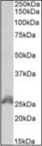 Homeobox B6 antibody, orb375466, Biorbyt, Western Blot image 