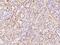 Solute Carrier Family 19 Member 3 antibody, 202927-T08, Sino Biological, Immunohistochemistry paraffin image 