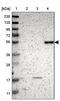 Leukocyte Immunoglobulin Like Receptor B5 antibody, PA5-52906, Invitrogen Antibodies, Western Blot image 