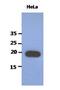 Poly(A) Binding Protein Interacting Protein 2 antibody, NBP2-22555, Novus Biologicals, Western Blot image 