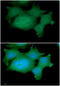 Adhesion Regulating Molecule 1 antibody, GTX57566, GeneTex, Immunocytochemistry image 