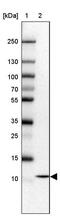 Cytochrome C Oxidase Assembly Factor 5 antibody, PA5-63480, Invitrogen Antibodies, Western Blot image 