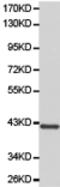 Neutrophil Cytosolic Factor 1 antibody, TA321099, Origene, Western Blot image 