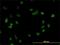 Cleavage Stimulation Factor Subunit 3 antibody, H00001479-M01, Novus Biologicals, Immunocytochemistry image 