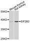 Eukaryotic Translation Initiation Factor 2B Subunit Beta antibody, abx006878, Abbexa, Western Blot image 