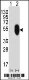 MLLT6, PHD Finger Containing antibody, 62-166, ProSci, Western Blot image 