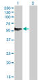 Nuclear Factor I B antibody, LS-C133920, Lifespan Biosciences, Western Blot image 