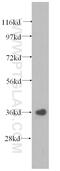 Eukaryotic Translation Initiation Factor 2 Subunit Alpha antibody, 11170-1-AP, Proteintech Group, Western Blot image 