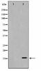 Histone Cluster 1 H2B Family Member H antibody, TA347811, Origene, Western Blot image 