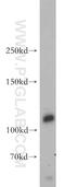 Shroom Family Member 1 antibody, 18218-1-AP, Proteintech Group, Western Blot image 