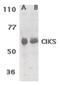 TRAF3 Interacting Protein 2 antibody, PA5-19989, Invitrogen Antibodies, Western Blot image 