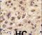 G Protein Nucleolar 3 antibody, PA5-11440, Invitrogen Antibodies, Immunohistochemistry paraffin image 