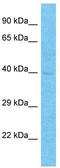 Transcription Factor Dp-2 antibody, TA329161, Origene, Western Blot image 