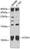 Antioxidant 1 Copper Chaperone antibody, GTX65531, GeneTex, Western Blot image 