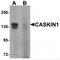 CASK Interacting Protein 1 antibody, MBS150854, MyBioSource, Western Blot image 