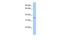 Glycosyltransferase 6 Domain Containing 1 antibody, GTX46116, GeneTex, Western Blot image 