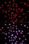 Bruton Tyrosine Kinase antibody, MBS126227, MyBioSource, Immunofluorescence image 