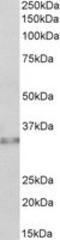 Caspase 6 antibody, TA320213, Origene, Western Blot image 