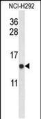 Ubiquinol-Cytochrome C Reductase Binding Protein antibody, PA5-48493, Invitrogen Antibodies, Western Blot image 