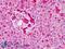 Smoothened, Frizzled Class Receptor antibody, LS-B4911, Lifespan Biosciences, Immunohistochemistry paraffin image 