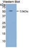 Semaphorin 4B antibody, LS-C296380, Lifespan Biosciences, Western Blot image 