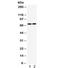 TNF Receptor Superfamily Member 1B antibody, R32033, NSJ Bioreagents, Western Blot image 
