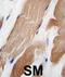 Integrin Linked Kinase antibody, abx033577, Abbexa, Immunohistochemistry frozen image 