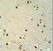 X-Ray Repair Cross Complementing 6 antibody, LS-C160674, Lifespan Biosciences, Immunohistochemistry paraffin image 