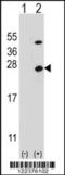 ATP Synthase Peripheral Stalk Subunit OSCP antibody, 63-519, ProSci, Western Blot image 