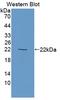 P63056 antibody, LS-C687366, Lifespan Biosciences, Western Blot image 