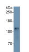 Hexokinase 1 antibody, LS-C300627, Lifespan Biosciences, Western Blot image 