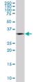 Polycomb Group Ring Finger 2 antibody, H00007703-M04, Novus Biologicals, Western Blot image 