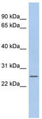 Chromosome 11 Open Reading Frame 53 antibody, TA333364, Origene, Western Blot image 