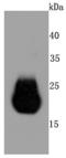 Claudin 5 antibody, A03260-1, Boster Biological Technology, Western Blot image 